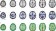 Seeing more than the Tip of the Iceberg: Approaches to Subthreshold Effects in Functional Magnetic Resonance Imaging of the Brain.