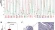 Clinical significance of TROAP in endometrial cancer and the antiproliferative and proapoptotic effects of TROAP knockdown in endometrial cancer cells: integrated utilization of bioinformatic analysis and in vitro test verification.