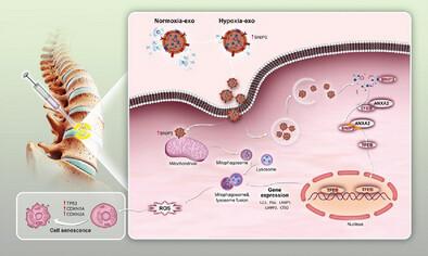 Hypoxia-Preconditioned BMSC-Derived Exosomes Induce Mitophagy via the BNIP3–ANAX2 Axis to Alleviate Intervertebral Disc Degeneration