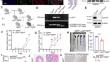 Fibroblast growth factor receptor 4 deficiency in macrophages aggravates experimental colitis by promoting M1-polarization.