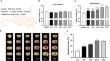 Nicotinamide riboside restores nicotinamide adenine dinucleotide levels and alleviates brain injury by inhibiting oxidative stress and neuroinflammation in a mouse model of intracerebral hemorrhage.