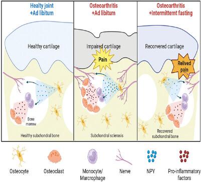 Intermittent Fasting Targets Osteocyte Neuropeptide Y to Relieve Osteoarthritis.