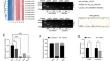 Circ-IP6K2 suppresses tumor progression by modulating the miR-1292-5p/CAMK2N1 signal in clear cell renal cell carcinoma