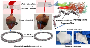 Toughening and Responsive Contractile Shape Memory Fibrous Membrane via Water for Mechanically Active Wound Dressing