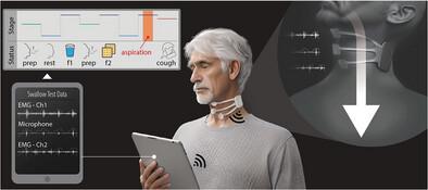 Automatic Clinical Assessment of Swallowing Behavior and Diagnosis of Silent Aspiration Using Wireless Multimodal Wearable Electronics.