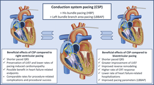 Conduction System Pacing: Hope, Challenges, and the Journey Forward.