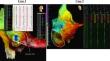 High-density visualization of antegrade fast pathway activation during atypical fast/slow atrioventricular nodal reentrant tachycardia in two cases.