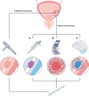 Optimizing cystoscopy and TURBT: enhanced imaging and artificial intelligence.