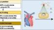 High-intensity Focused Ultrasound-A New Choice to Conduct Pulmonary Artery Denervation.