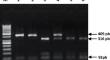 Association of HLA-G 3'UTR polymorphisms with hepatitis B virus infection in Tunisian population.