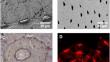 2D vs. 3D Evaluation of Osteocyte Lacunae - Methodological Approaches, Recommended Parameters, and Challenges: A Narrative Review by the European Calcified Tissue Society (ECTS).