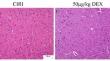 TREK-1 channel as a therapeutic target for dexmedetomidine-mediated neuroprotection in cerebral ischemia.