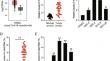 KIAA1429 promotes the malignancy of oral squamous cell carcinoma by regulating CA9 m6A methylation