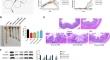 Hinesol attenuates DSS-induced ulcerative colitis through the suppression of Src-mediated NF-κB and chemokine signaling pathway.