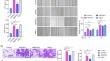 METTL3 promotes immature dental pulp stem cells-induced angiogenesis by regulating ETS1 mRNA stability in an m<sup>6</sup>A-HuR-dependent manner.