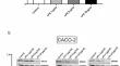 Modulation of miR-155-5p signalling via 5-ASA for the prevention of high microsatellite instability: an in vitro study using human epithelial cell lines.