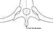 Relationship between epidural catheter migration beneath the skin and subcutaneous fat thickness assessed using postoperative CT imaging: a retrospective cross-sectional study.