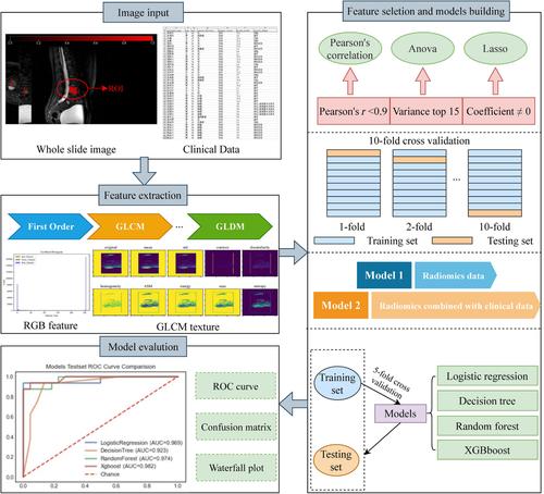 Radiomics Based on Multimodal magnetic resonance imaging for the Differential Diagnosis of Benign and Malignant Vertebral Compression Fractures.