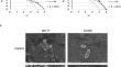 Antimicrobial efficacy and amino acid substitutions associated with susceptibility to the tellurium compound AS101 against Haemophilus influenzae and Haemophilus parainfluenzae.