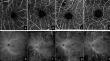 The Role of Widefield Optical Coherence Tomography Angiography in Assessing the Severity of Diabetic Retinopathy.