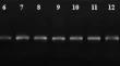 Exploring secondary structures within the nuclear ribosomal DNA internal transcribed spacers (nr DNA ITS) for enhanced phylogenetic insights in Medicago sativa (alfalfa)