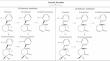 Esketamine in depression: putative biomarkers from clinical research.