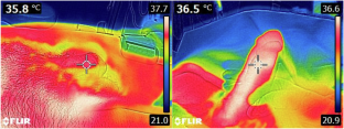 Use of thermographic imaging for the evaluation of erectile dysfunction and Peyronie’s disease