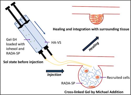 Development of an Injectable, ECM-Derivative Embolic for the Treatment of Cerebral Saccular Aneurysms
