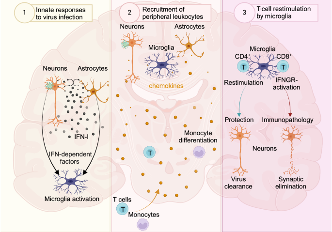 Orchestration of antiviral responses within the infected central nervous system