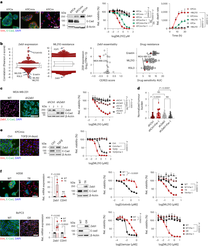 Zeb1 mediates EMT/plasticity-associated ferroptosis sensitivity in cancer cells by regulating lipogenic enzyme expression and phospholipid composition