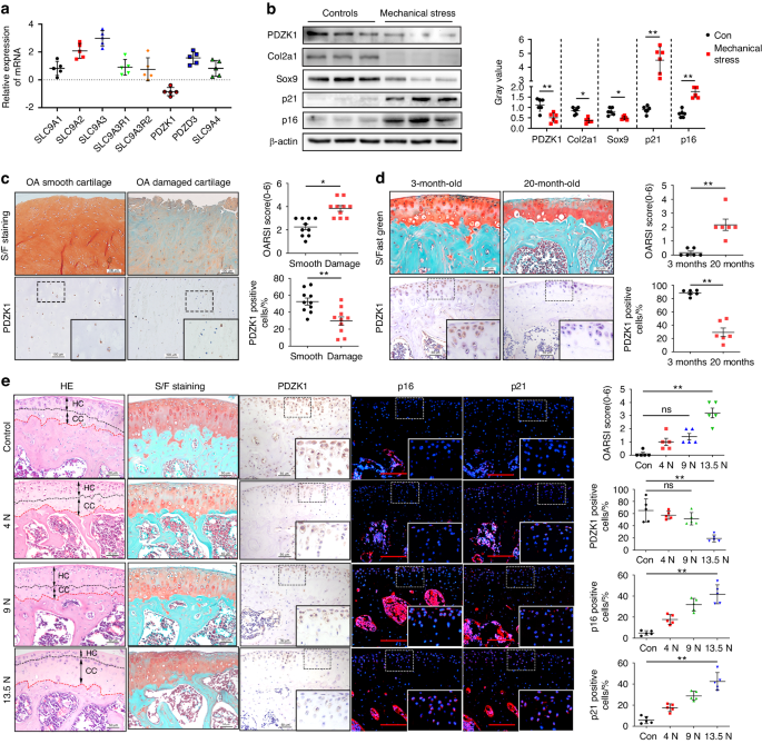 PDZK1 protects against mechanical overload-induced chondrocyte senescence and osteoarthritis by targeting mitochondrial function