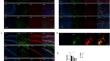 Scavenger Receptor Class B Type I Modulates Epileptic Seizures and Receptor α2δ-1 Expression.