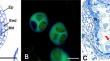 Histochemical and ultrastructural analysis of tapetum and sporoderm development in relation to precocious pollenkitt production of Garcinia dulcis (Roxb.) Kurz.