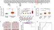 GPC2 promotes prostate cancer progression via MDK-mediated activation of PI3K/AKT signaling pathway