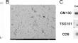 The diagnostic value of serum exosomal SNORD116 and SNORA21 for NSCLC patients.