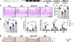 Melatonin via MTNR1B regulates METTL3 to protect ileum cell differentiation.