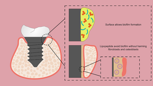 Production and characterization of the lipopeptide with anti-adhesion for oral biofilm on the surface of titanium for dental implants.