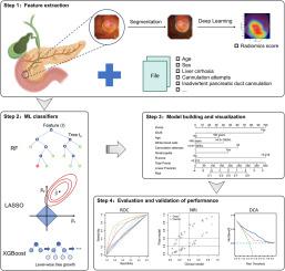 Duodenal papilla radiomics-based prediction model for post-ERCP pancreatitis using machine learning: a retrospective multicohort study