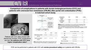 Comparison of Complications in Patients with Ductal Cholangiocarcinoma (CCC) and Patients with Colorectal Liver Metastases (CRLMs) After Portal Vein Embolization (PVE): A Matched Cohort Study.