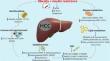 Epidemiology, pathophysiology and clinical aspects of Hepatocellular Carcinoma in MAFLD patients.