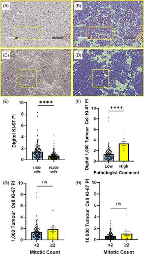 Assessment of Ki-67 and mitoses in pituitary neuroendocrine tumours-Consistency counts.