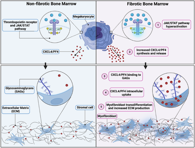 Proteomic screening identifies PF4/Cxcl4 as a critical driver of myelofibrosis