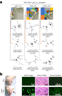 A humanized mouse that mounts specific and mature antibody and autoantibody responses