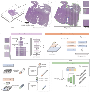 A transformer-based weakly supervised computational pathology method for clinical-grade diagnosis and molecular marker discovery of gliomas