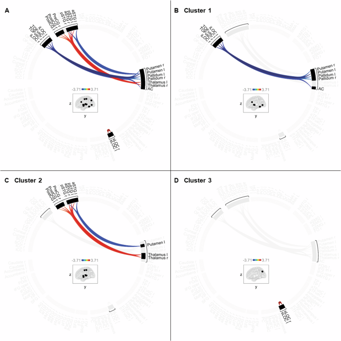 Phenomena of hypo- and hyperconnectivity in basal ganglia-thalamo-cortical circuits linked to major depression: a 7T fMRI study.