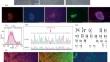 Creation of Induced Pluripotent Stem Cells RCMGi014-A Using Reprogramming of Urine Cells of a Patient with Fibrodysplasia Ossificans Progressiva Associated with Heterozygous Mutation in the ACVR1 Gene