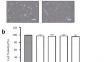 A mechanistic study on the toluidine blue/ photodynamic therapy inhibition of lipopolysaccharide-induced inflammatory response in rat gingival fibroblasts.