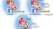 Novel Cardiac Myosin Inhibitor Therapy for Hypertrophic Cardiomyopathy in Adults: A Contemporary Review