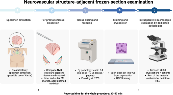 Intraoperative technologies to assess margin status during radical prostatectomy - a narrative review.