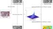 Stochastic biogeography-based learning improved RIME algorithm: application to image segmentation of lupus nephritis